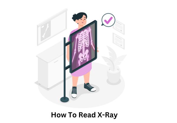 How To Read X-Ray