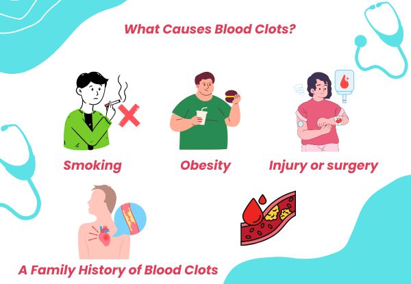 What Causes Blood Clots