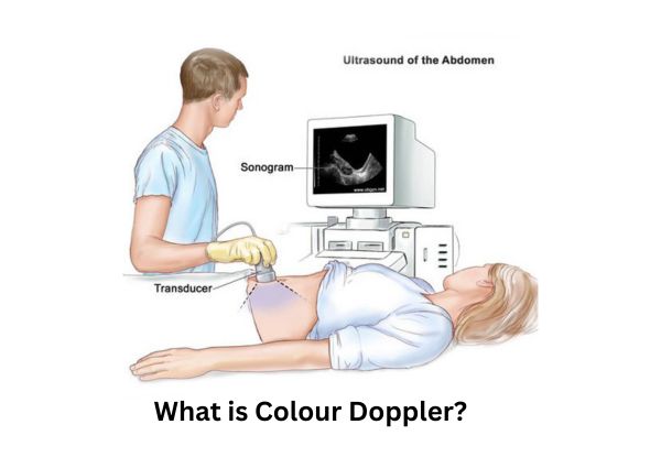 colour doppler