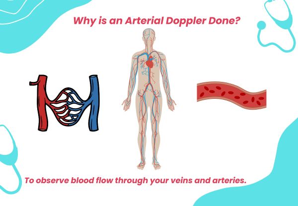 Why is an Arterial Doppler Done