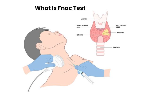 what is fnac test