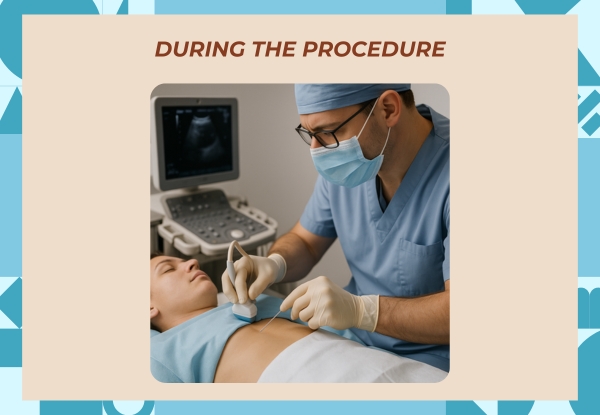 During the Procedure