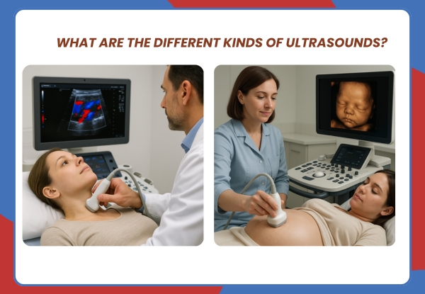 What are the different kinds of ultrasounds?