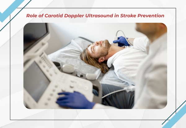 Role of Carotid Doppler Ultrasound in Stroke Prevention