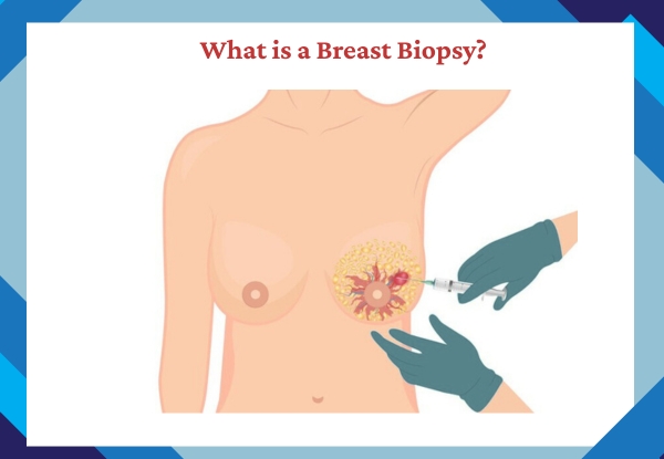 Biopsy test near me
