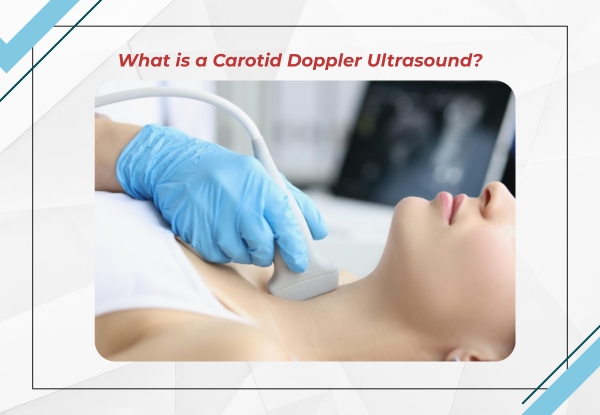 What is a Carotid Doppler Ultrasound?
