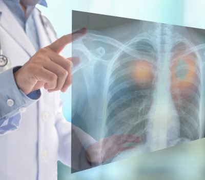 ASU - MCU X Ray 1