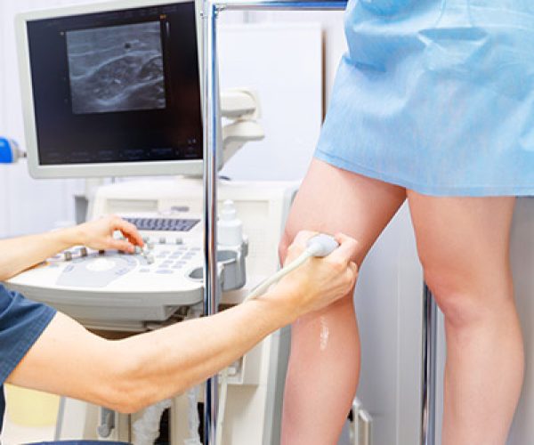 Arterial-Doppler-Ultrasound-2