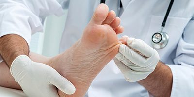 Diabetic Foot Management